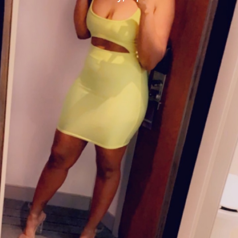 Neon mini dress